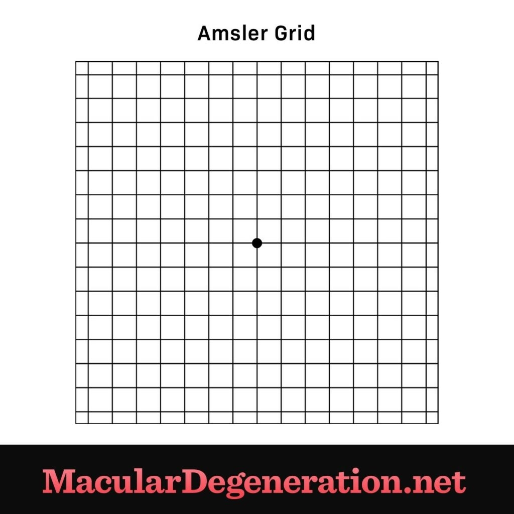 amsler grid printable