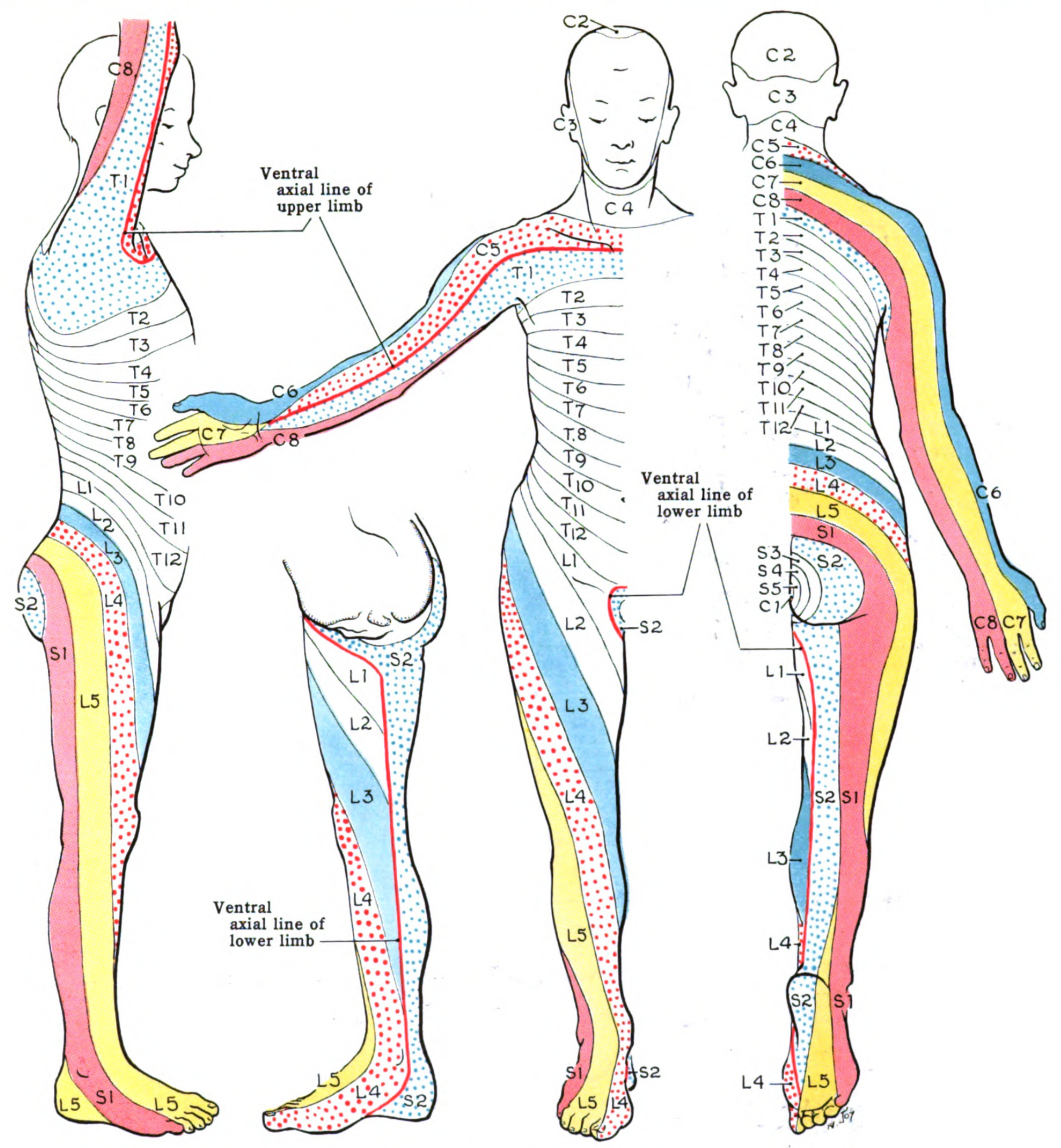 Figure Dermatome Map A Dermatome Is An StatPearls NCBI Bookshelf